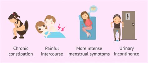 Retroverted Uterus (Tilted Uterus): Cause, Symptoms, .